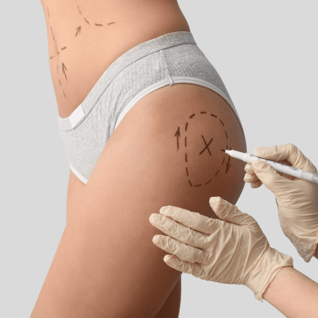 MLD Care Package-10pk at Embodied Healing Center in Melbourne, FL